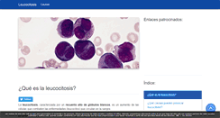 Desktop Screenshot of leucocitosis.com